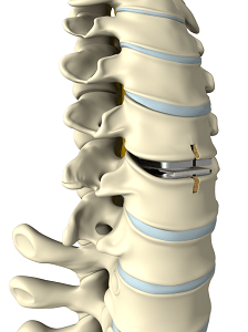 Spine