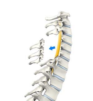 Spine