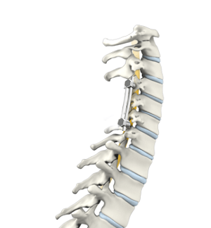 Spine