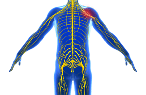 Peripheral Nerve Compression